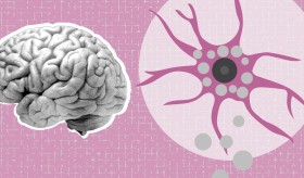 Foamy microglia link oxylipins to disease progression in multiple sclerosis