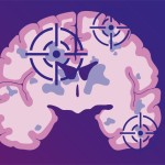 New biomarker and therapeutic target identified for MS