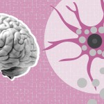 Foamy microglia link oxylipins to disease progression in multiple sclerosis
