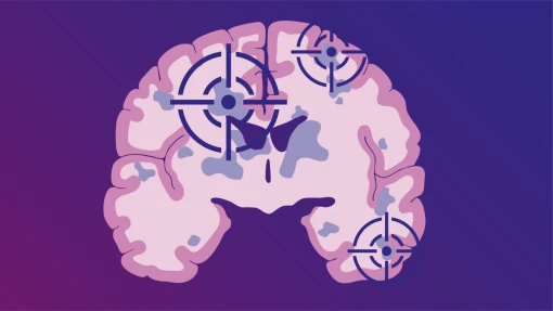 New biomarker and therapeutic target identified for MS